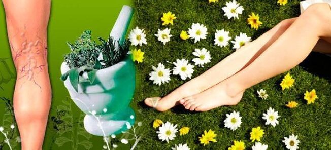 Folk remedies for varicose veins on the legs, contribute to rapid recovery